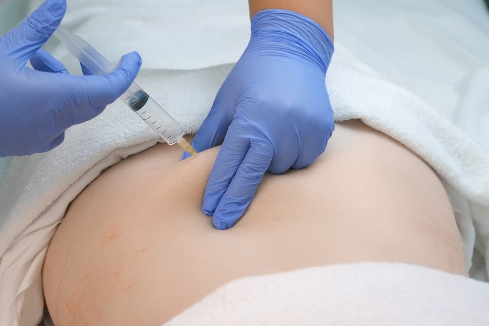 Ozônio Terapia